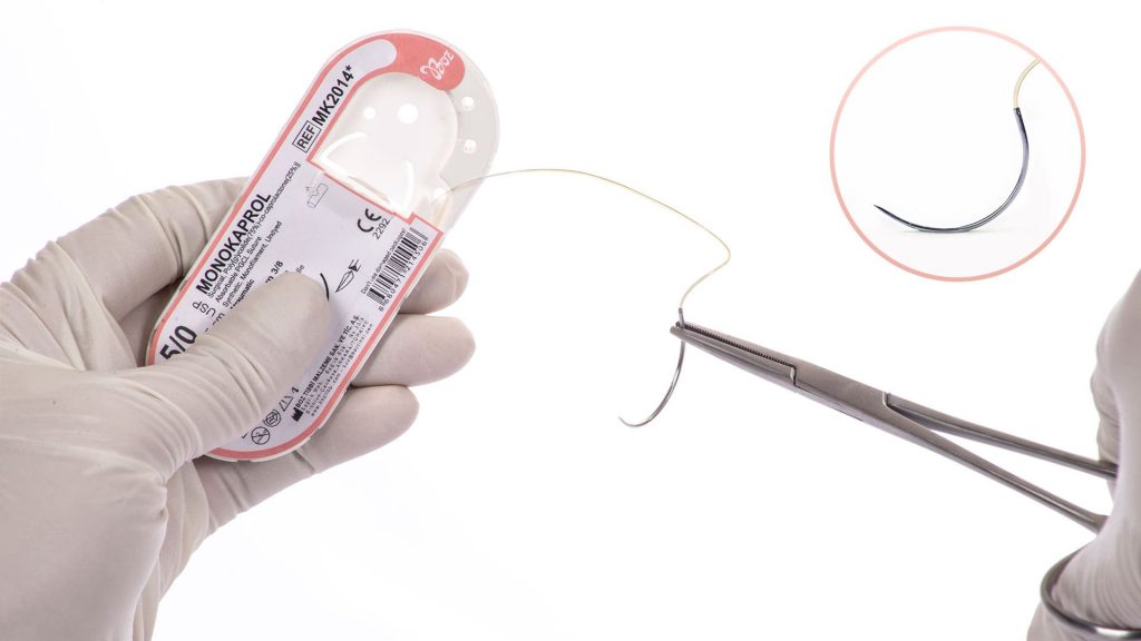 Dental Suture Polyglycolide-co-caprolactone (PGCL) - Monokaprol